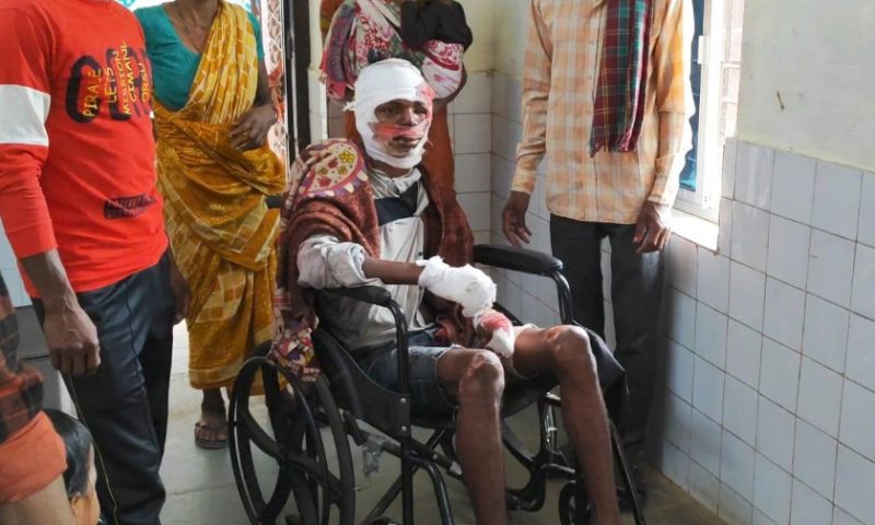 ଭାରସାମ୍ୟ ହରାଇ ମୋଟର ସାଇକେଲ ଦୁର୍ଘଟଣାଗ୍ରସ୍ତ, ଜଣେ ଗୁରୁତର