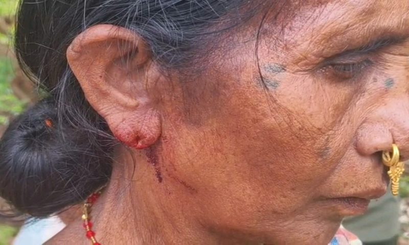 ମହିଳାଙ୍କ କାନ  ଓ ନାକରୁ ଝାମ୍ପି ନେଲେ  ଦେଢ଼ ତୁଳା ସୁନା ସୁନା… ଦିନ ଦିପହର ରେ ରାସ୍ତା ରୁ ଲୁଟ…..